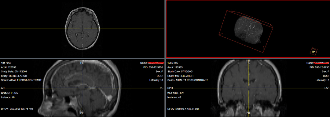Zimam PACS 3D Visualization