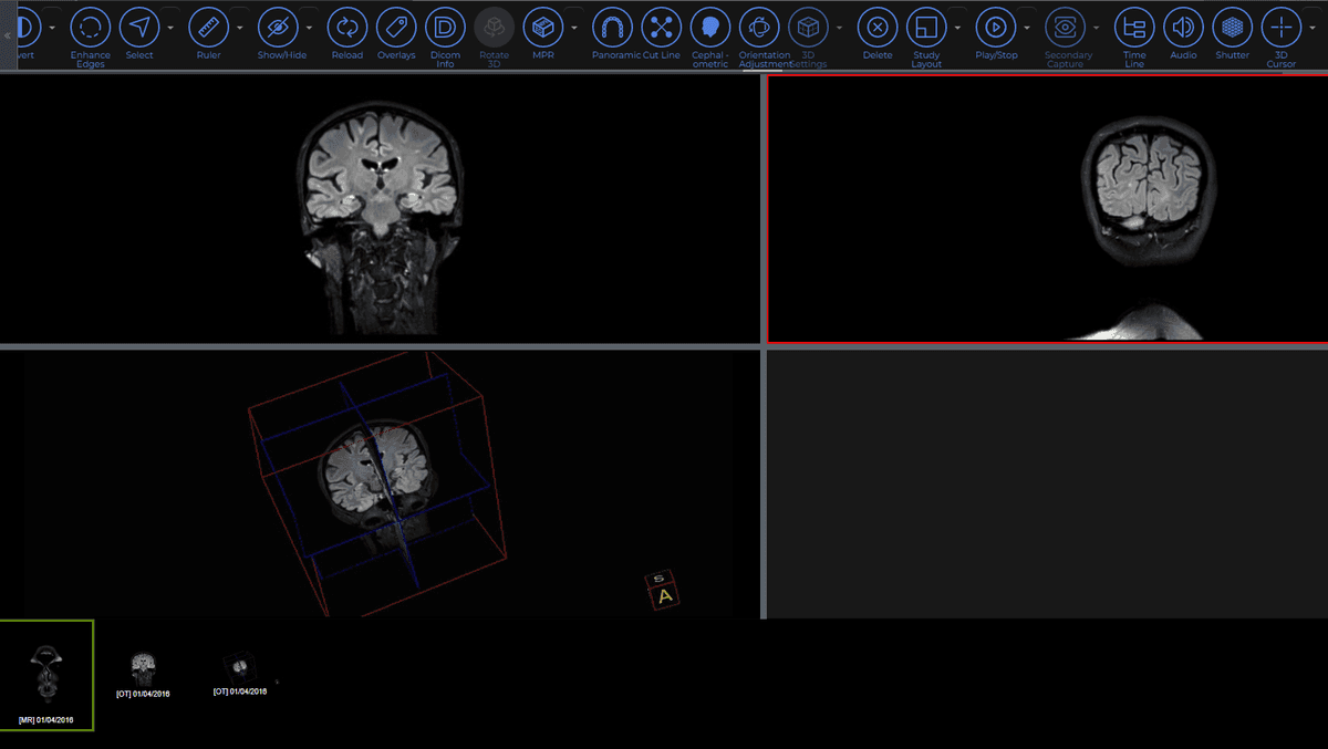 Zimam PACS Viewer Interface
