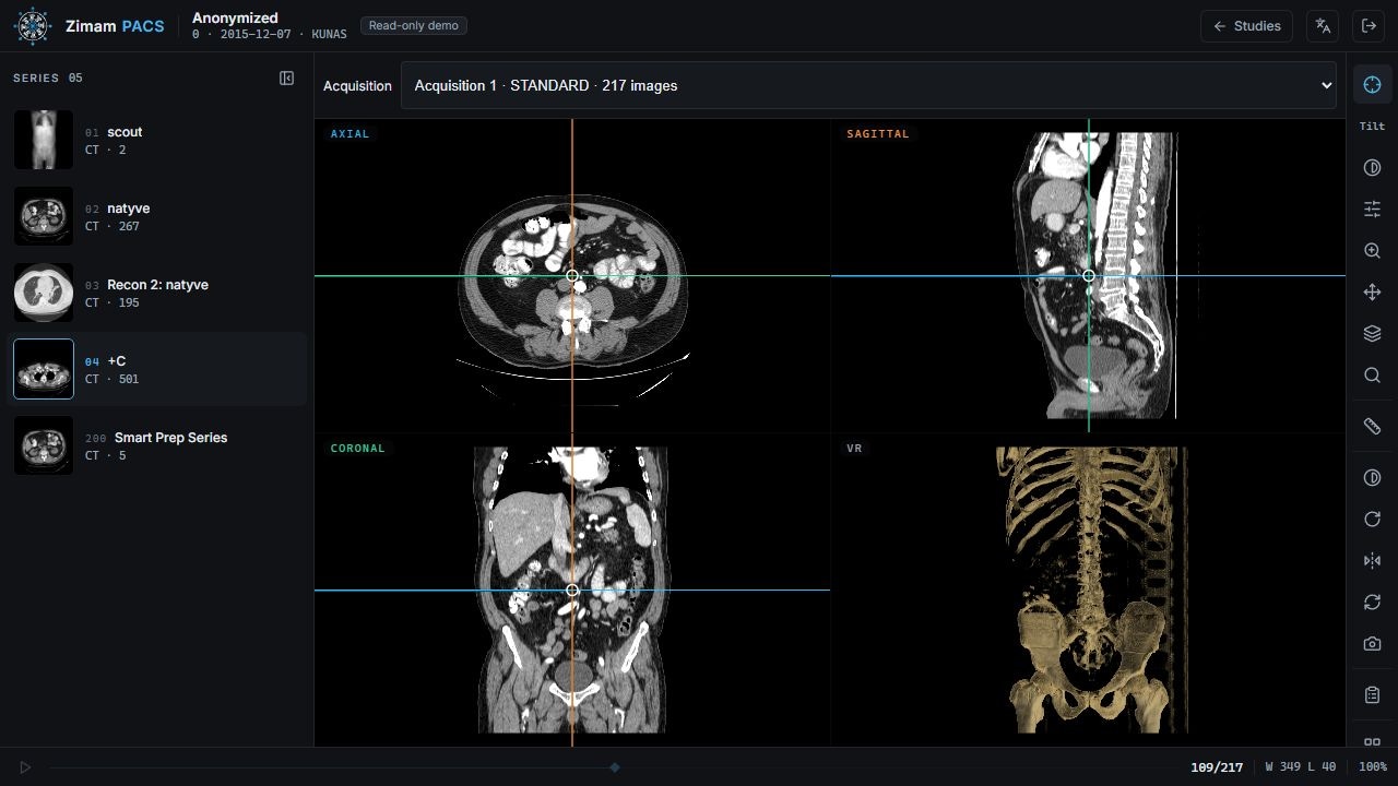 Zimam PACS showing linked axial, sagittal, and coronal CT views and a 3D bone reconstruction.