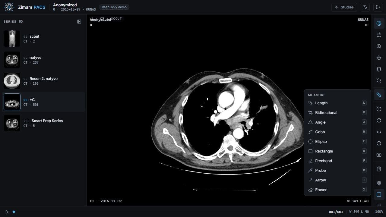 Zimam PACS viewing an anonymized CT slice with its measurement tools visible.