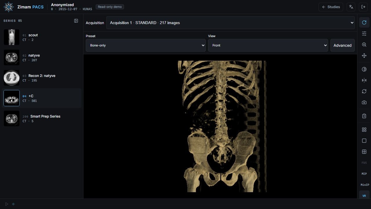 Zimam PACS showing a 3D bone volume with rendering preset and patient view controls.